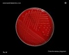 Listeria monocytogenes culture on blood agar
